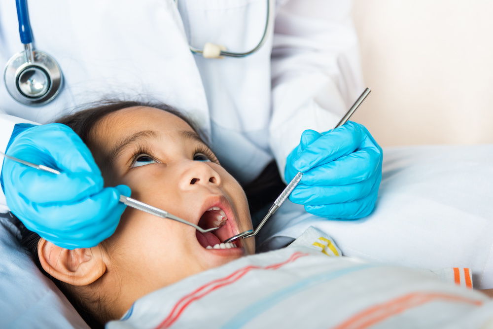 baby teeth and cavities