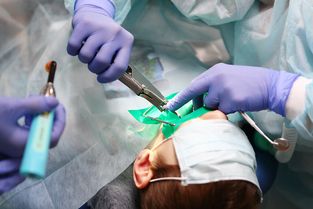 Pediatric General Anesthesia
